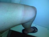 I'm developing some tan lines