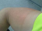 These little salt crystals actually develop on my arms after a few hours of riding.